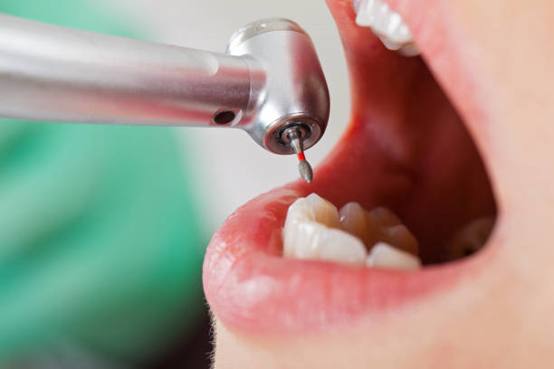 Best Emergency Dentist for Special Needs Patients in Ben Wheeler, TX